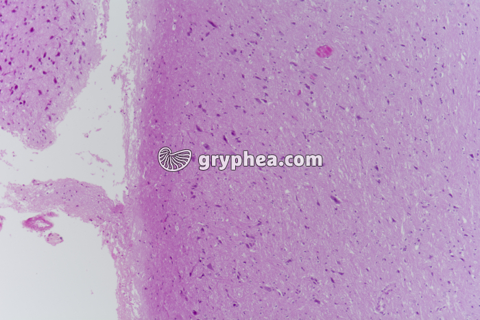 Encéphale CL coupe totale x25 - gryphea.com